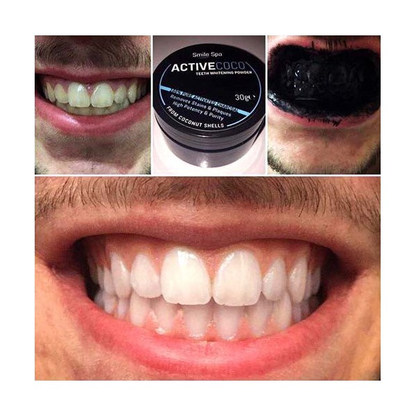 Activated Carbon Black Powder for Teeth Whitening - Before/After